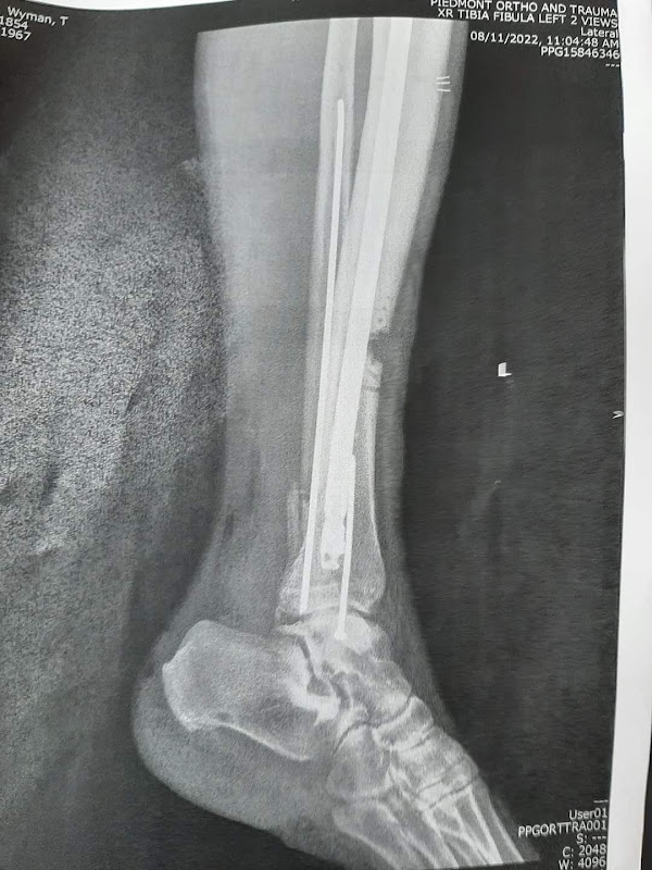 Piedmont Orthopedics and Sports Medicine of Athens - Trauma - Health in Athens, GA